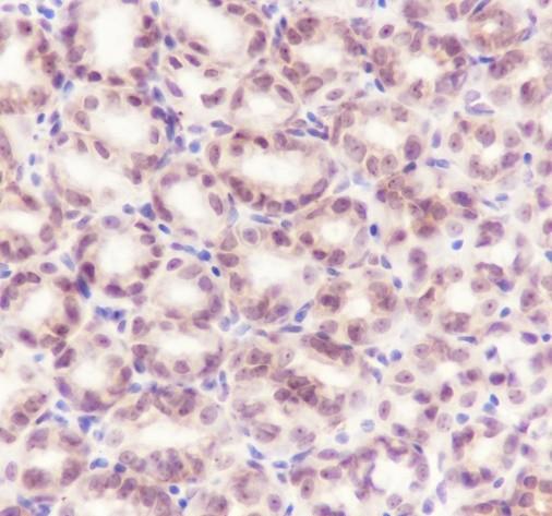 Recombinant Cyclin D2 Monoclonal Antibody - small - 4