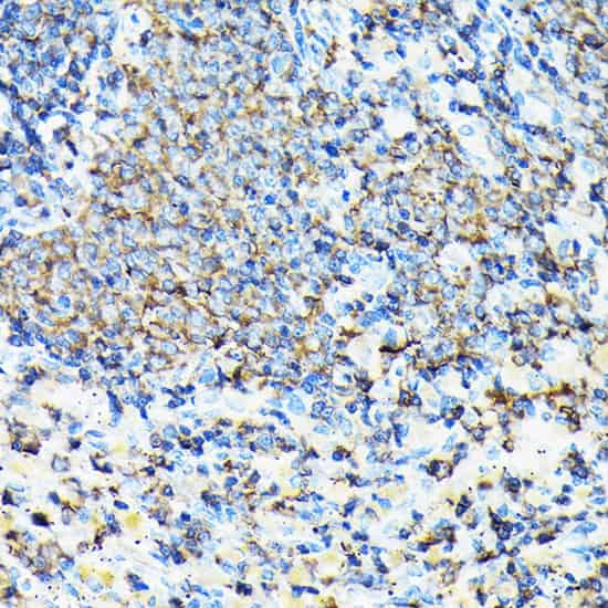 Immunohistochemistry of paraffin-embedded mouse spleen using CORO1A Polyclonal antibody at dilution of 1:100 (40x lens).Perform high pressure antigen retri