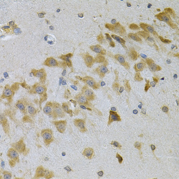 Immunohistochemistry of paraffin-embedded Mouse brain using IGFBP4 Polyclonal Antibody at dilution of 1:100 (40x lens).