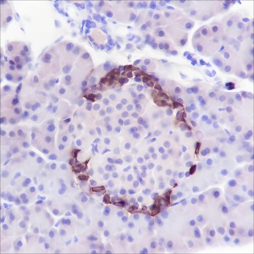 Recombinant GLP-1 Monoclonal Antibody - small - 4