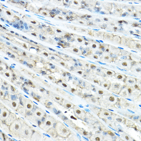 Immunohistochemistry of paraffin-embedded mouse stomach using VCP Polyclonal Antibody at dilution of 1:100 (40x lens).Perform high pressure antigen retrieval with 10 mM citrate buffer pH 6.0 before commencing with IHC staining protocol.