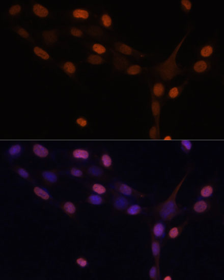 Immunofluorescence analysis of NIH-3T3 cells using PRKCB Polyclonal Antibody at dilution of  1:100 (40x lens). Blue: DAPI for nuclear staining.