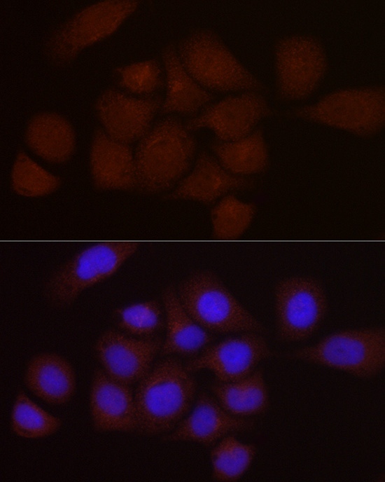 PGC1 alpha Polyclonal Antibody - 3