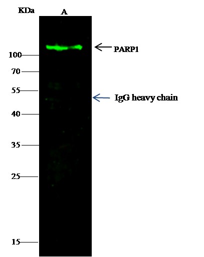 PARP-1/PARP Monoclonal Antibody - small - 5
