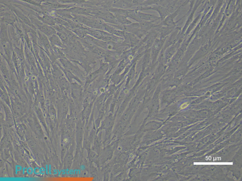 Human Synovial Cell Complete Medium - 5