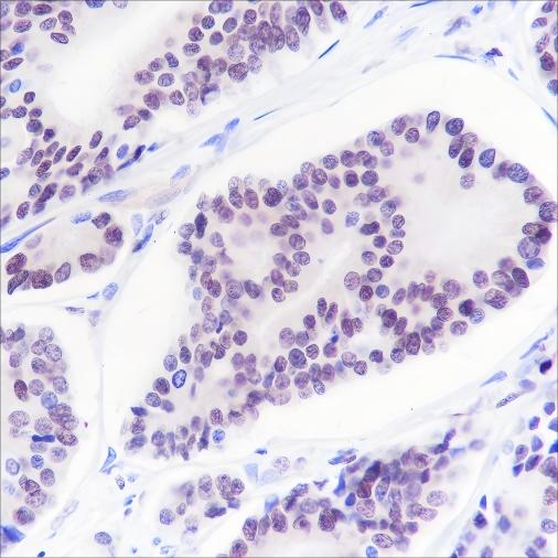 Recombinant ERG Monoclonal Antibody - 3
