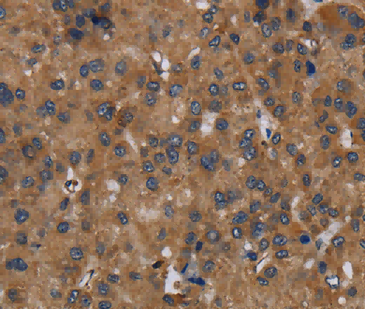 NDUFS8 Polyclonal Antibody - 2
