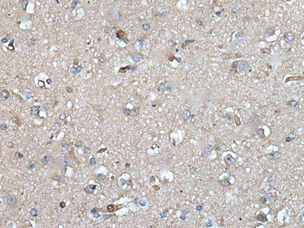 Immunohistochemistry of paraffin-embedded Human brain tissue  using UMPS Polyclonal Antibody at dilution of 1:40(?200)