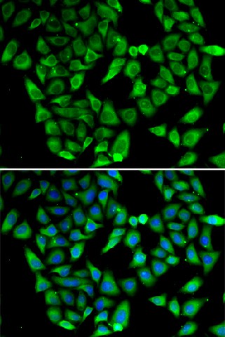 Immunofluorescence analysis of HeLa cells using ASIP Polyclonal Antibody