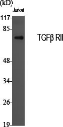 Western Blot analysis of Jurkat cells using TGF β Receptor II Polyclonal Antibody at dilution of 1:2000.