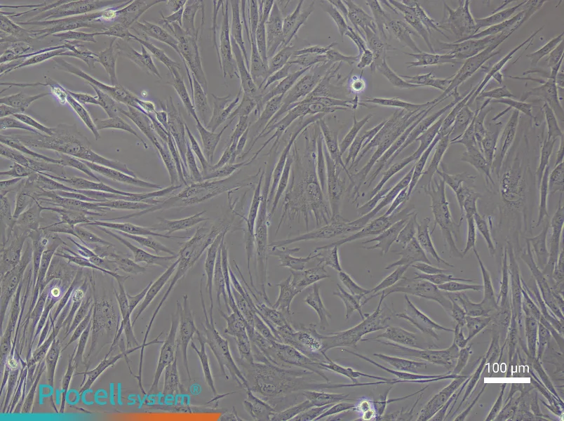 Human Colonic Fibroblast Complete Medium - 1