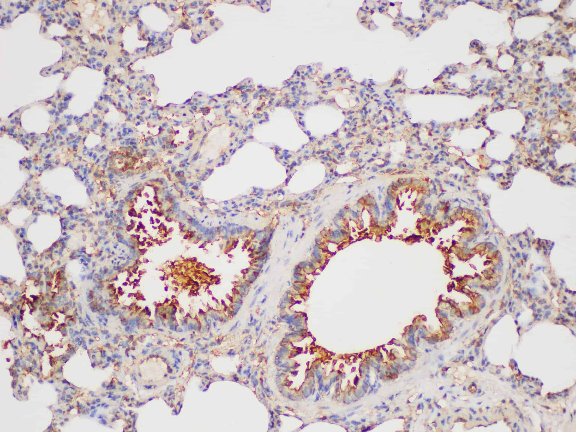 Immunohistochemistry of paraffin-embedded Rat lung using GSTP1 Polycloanl Antibody at dilution of 1:100