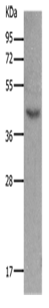 Western Blot analysis of Mouse muscle tissue using MC5R Polyclonal Antibody at dilution of 1:1200