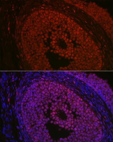 Immunofluorescence analysis of rat ovary using FOXL2 Polyclonal Antibody at dilution of 1:100 (40x lens). Blue: DAPI for nuclear staining.