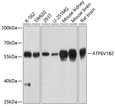 Western blot analysis of extracts of various cell lines using ATP6V1B2 Polyclonal Antibody at 1:1000 dilution.