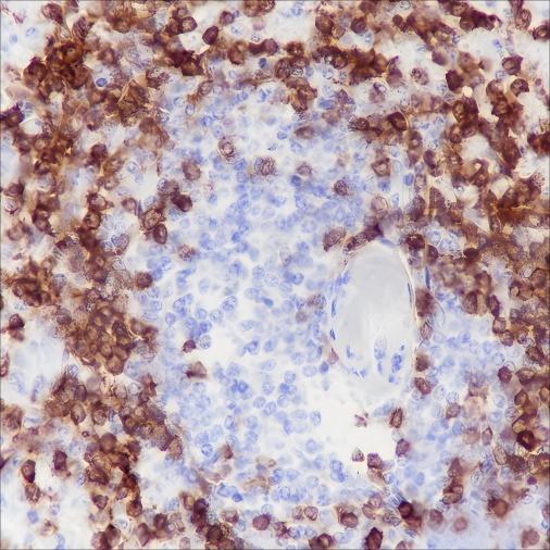 Recombinant CD79a Monoclonal Antibody - 2