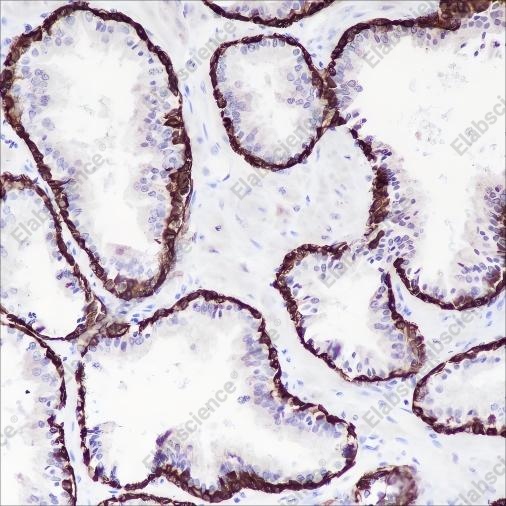 Recombinant Keratin 5/6 Monoclonal Antibody - 5