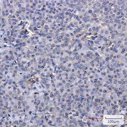 Recombinant PELP1 Monoclonal Antibody - 3
