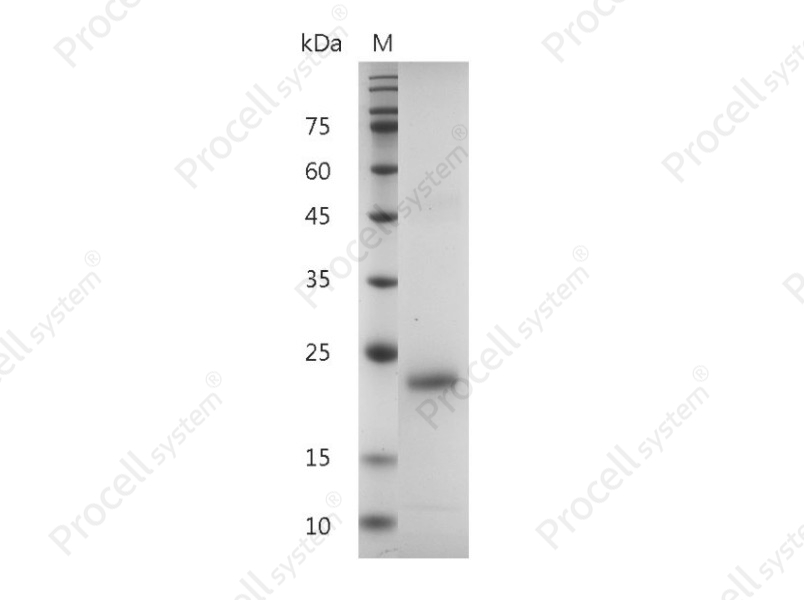 IL-6/IFN-&beta;2/BSF-2, Human, Recombinant