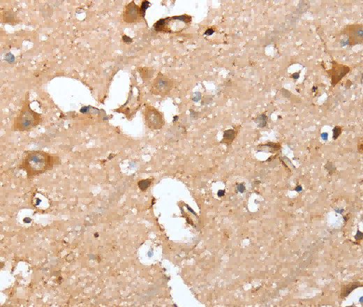 CAPG Polyclonal Antibody - 2