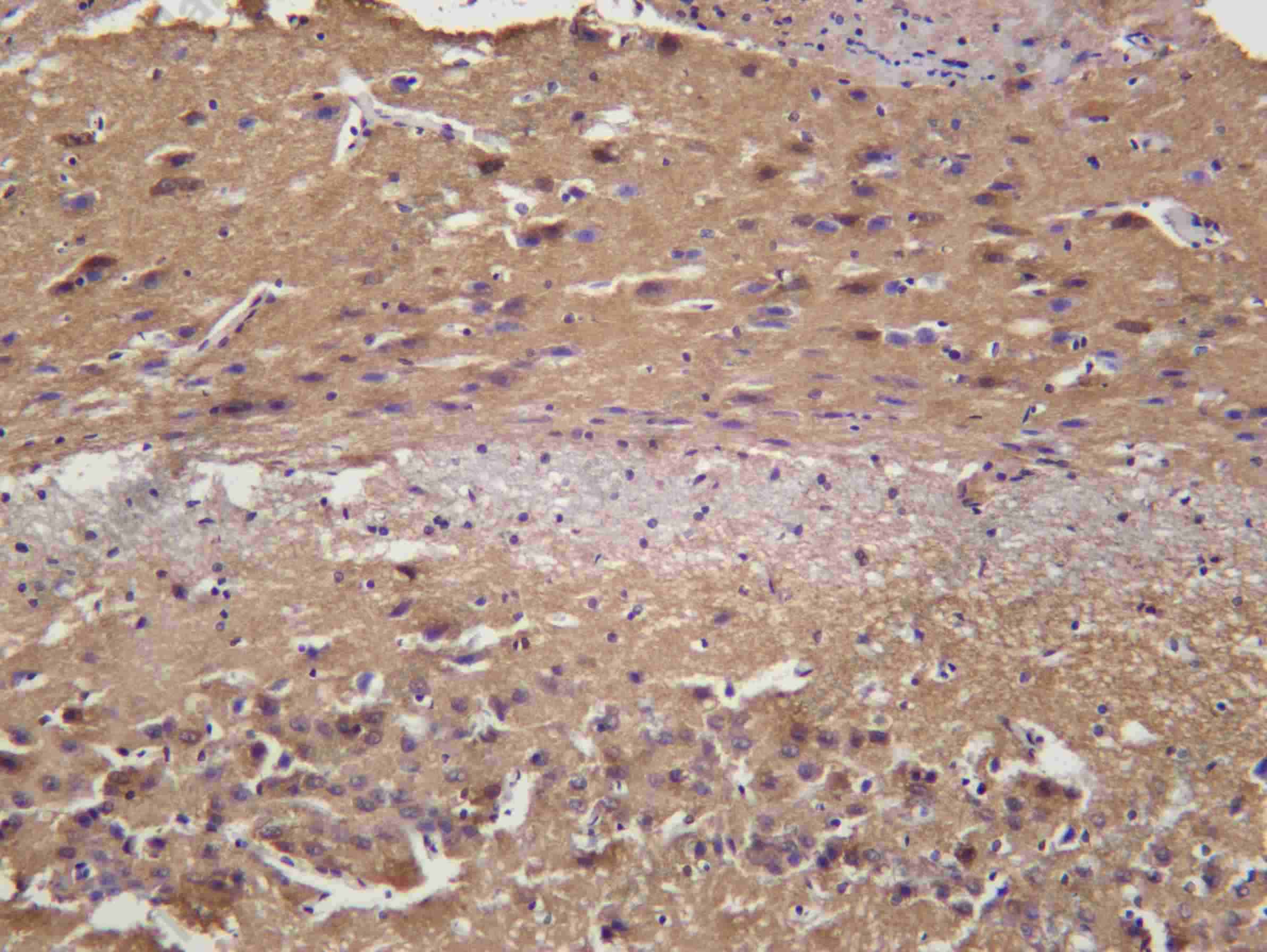 Recombinant TF Monoclonal Antibody - 3
