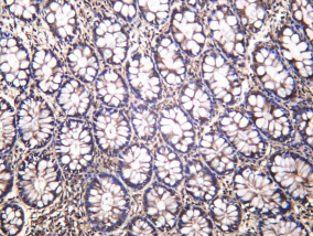 Recombinant EphB3 Monoclonal Antibody - 1