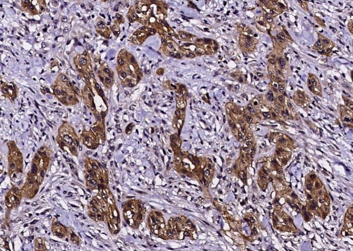 EGFR/HER1/ErbB1 Monoclonal Antibody - small - 3