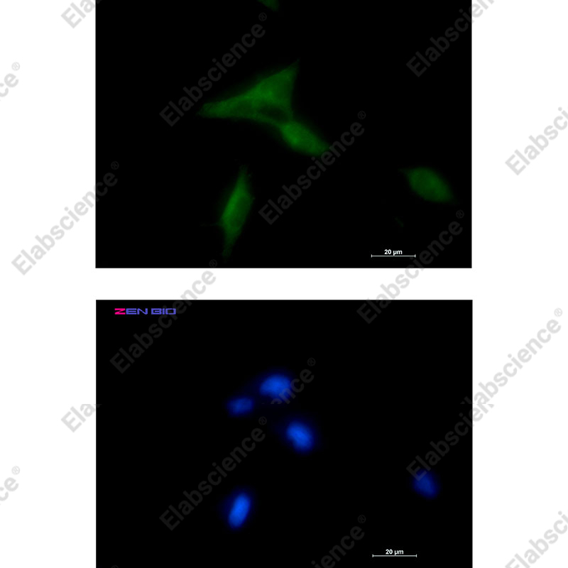 Recombinant NDUFAF1 Monoclonal Antibody - 2
