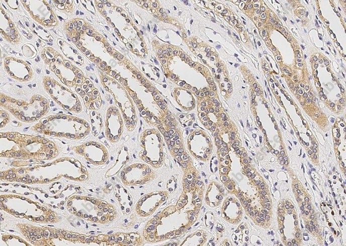 RAGE/AGER Monoclonal Antibody - 1