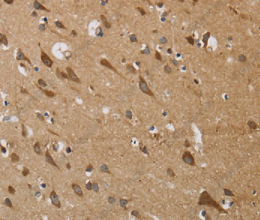 KCNMB4 Polyclonal Antibody - 3