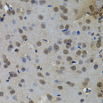 Immunohistochemistry of paraffin-embedded Rat brain using IL33 Polyclonal Antibody