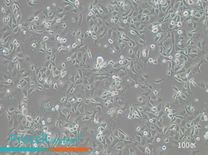 Anglne Cell Complete Medium - 2