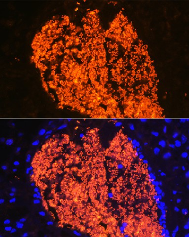 Immunofluorescence analysis of Mouse placenta using HBA2 Polyclonal antibody at dilution of 1:100 (40x lens). Blue: DAPI for nuclear staining.