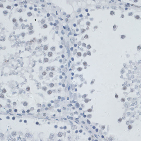 Immunohistochemistry of paraffin-embedded Rat testis using MSH6 Polyclonal Antibody at dilution of  1:100 (40x lens).