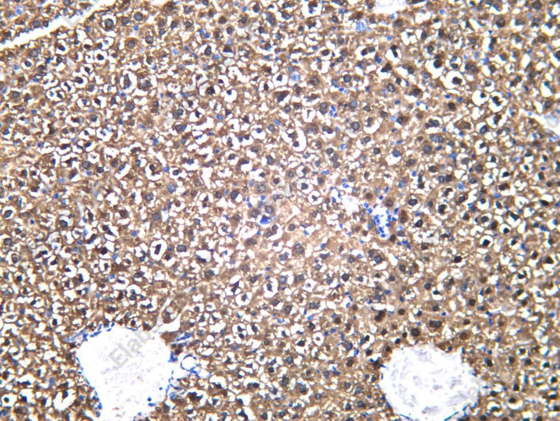 Recombinant ABHD5 Monoclonal Antibody - 1