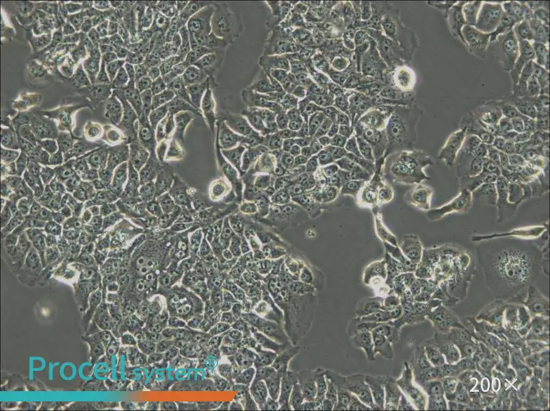 JIMT-1 Cell Complete Medium - small - 5