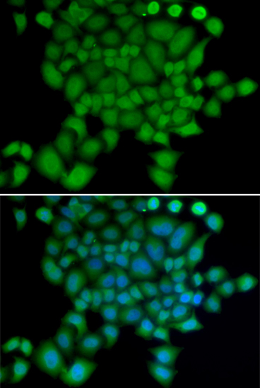 Immunofluorescence analysis of U2OS cells using NEDD9 Polyclonal Antibody