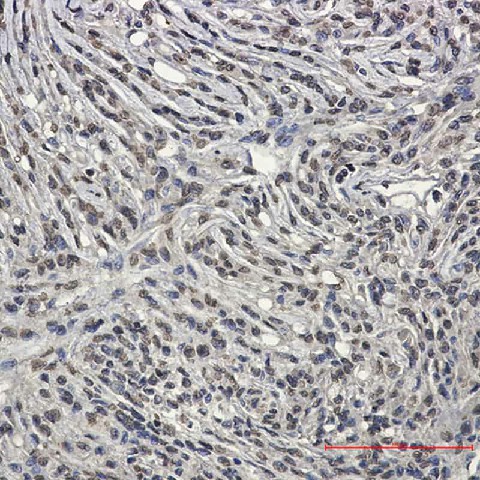 Immunohistochemistry of Bcr in paraffin-embedded Human Brain using Bcr Rabbit mAb at dilution 1:50