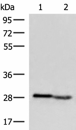 Western blot analysis of Human fetal intestines tissue and Human fetal liver tissue lysates  using KLRB1 Polyclonal Antibody at dilution of 1:800