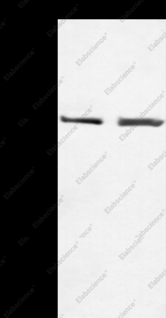 TERT Polyclonal Antibody - 1