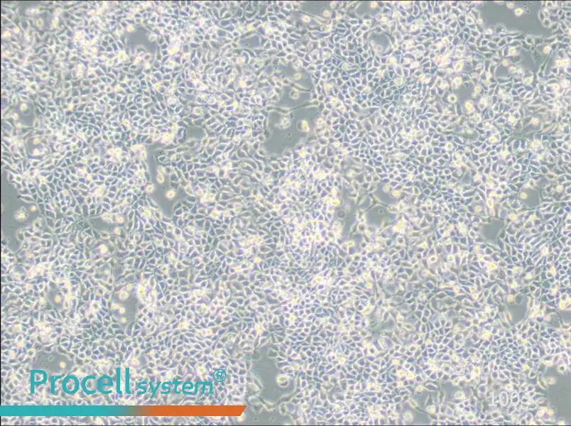 RT-112 Cell Complete Medium - 2