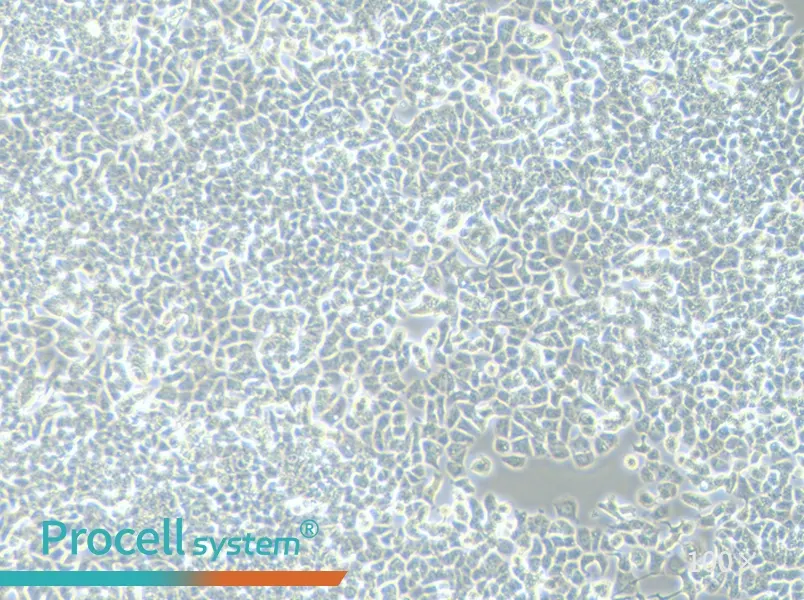 T-47D Cell Complete Medium - 2