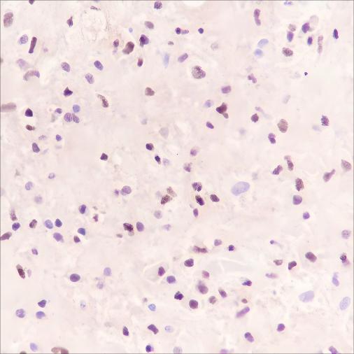 Recombinant SOX11 Monoclonal Antibody-searchlist-1