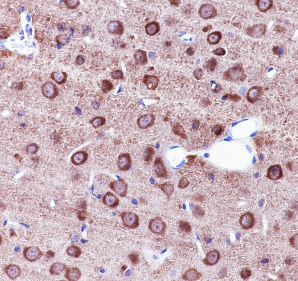 Recombinant DNAJC6 Monoclonal Antibody - small - 5