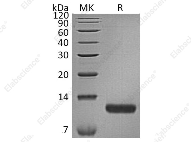 Recombinant Human CCL17/TARC Protein (His Tag) - 1