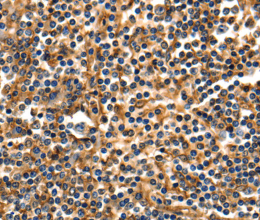 ANXA5 Polyclonal Antibody - 3