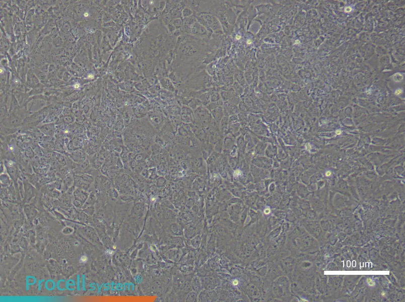 Mouse Embryonic HepatoblastsMouse Embryonic Hepatoblasts - 3