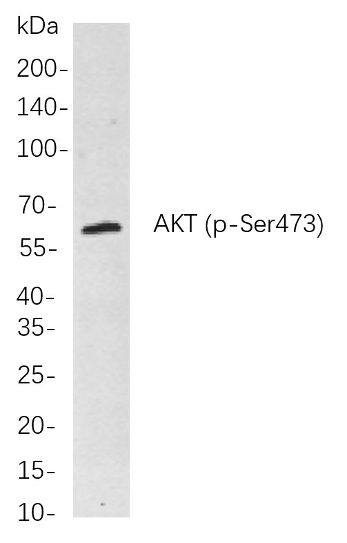 Recombinant Phospho-Akt (pan) (Ser473) Monoclonal Antibody-searchlist-1