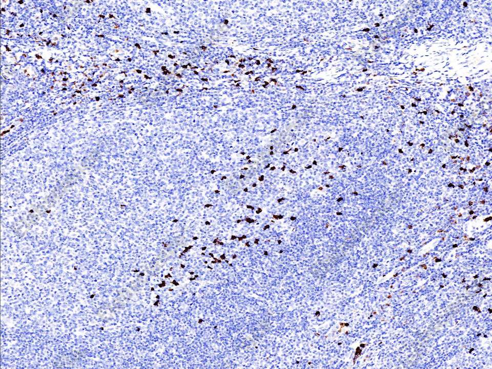 Recombinant S100A9 Monoclonal Antibody - 2