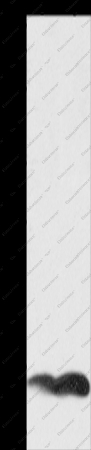 PFN1 Polyclonal Antibody - 1